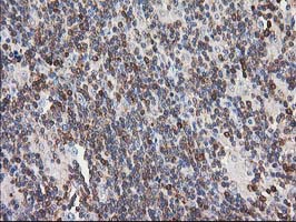 m04244 anti pip5k2 alpha pip4k2a mouse monoclonal antibody clone id oti3d3 ihc testing 4