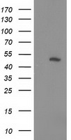 HEK293T cells were transfected with the pCMV6-ENTRY control (Left lane) or pCMV6-ENTRY PIP4K2A (Right lane) cDNA for 48 hrs and lysed