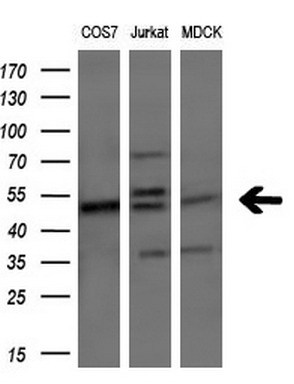 Western blot analysis of extracts (10ug) from 3 different cell lines by using anti-PIP4K2A monoclonal antibody (1:200)
