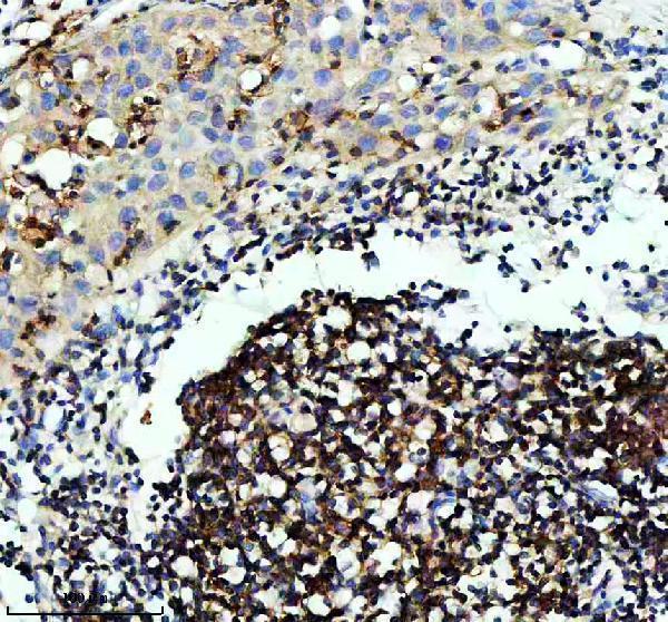m04245 1 coro1a primary antibodies ihc testing 1_1