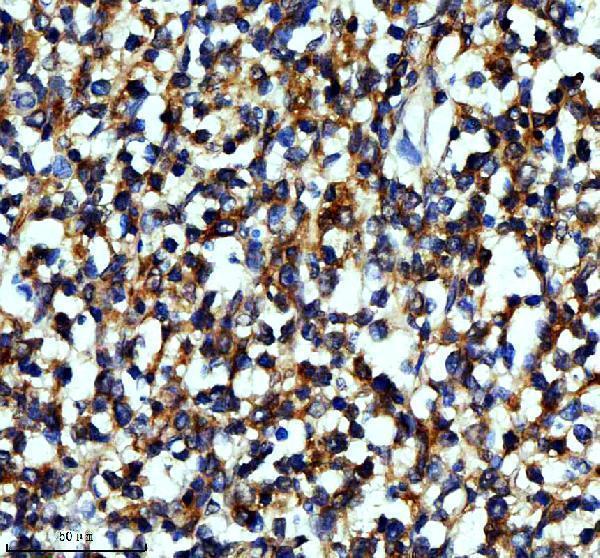 m04245 1 coro1a primary antibodies ihc testing 2_1