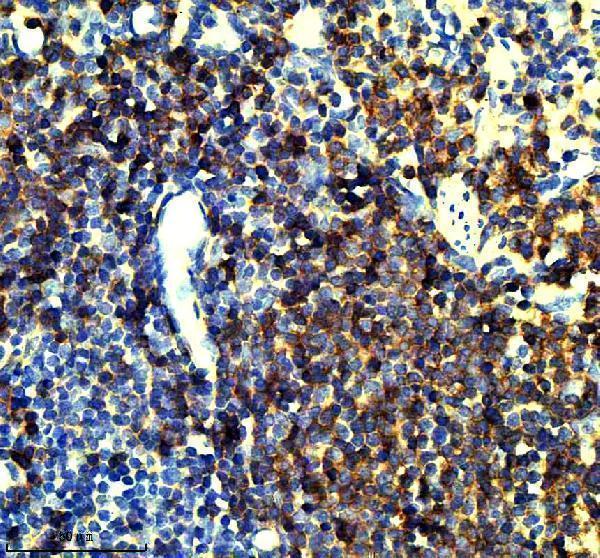 m04245 1 coro1a primary antibodies ihc testing 3_1