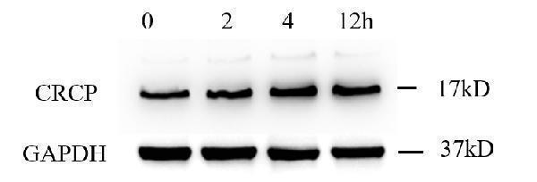  Western blot analysis of CRCP using anti-CRCP antibody (M04247)
