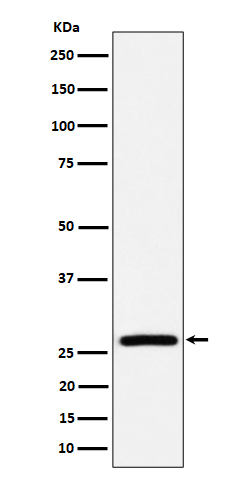 Western blot analysis of AK2 expression in HepG2 cell lysate
