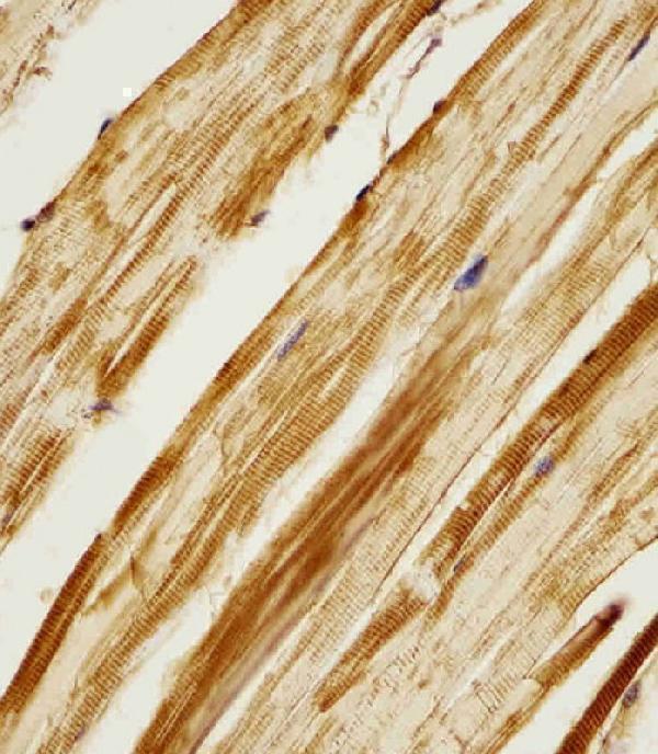 M04253 staining Zebrafish ak2 in zebra fish body tissue sections by Immunohistochemistry (IHC-P -paraformaldehyde-fixed, paraffin-embedded sections)