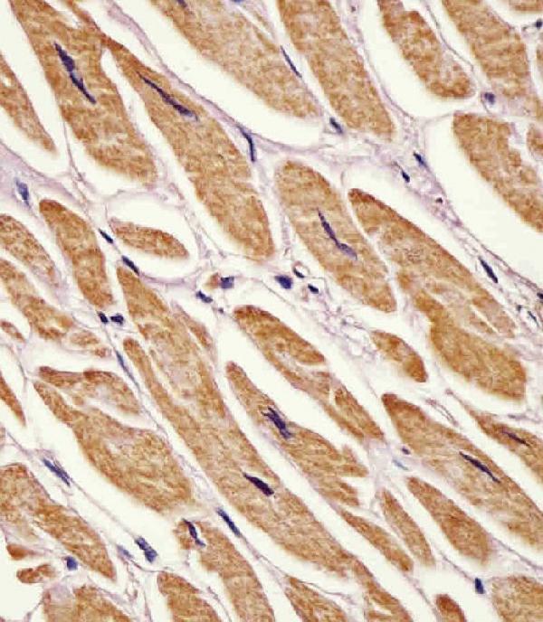 M04253 staining Zebrafish ak2 in human heart tissue sections by Immunohistochemistry (IHC-P -paraformaldehyde-fixed, paraffin-embedded sections)