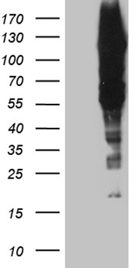 HEK293T cells were transfected with the pCMV6-ENTRY control (Left lane) or pCMV6-ENTRY GTF2IRD1 (Right lane) cDNA for 48 hrs and lysed