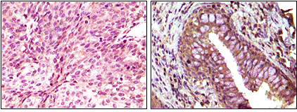 m04270 ephb6 primary antibodyes ihc testing 2