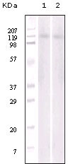 m04270 ephb6 primary antibodyes wb testing 1