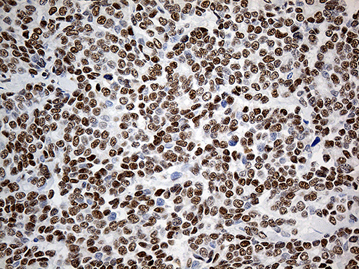 m04277 anti fklf  klf11 klf11 mouse monoclonal antibody clone id oti5a1 ihc testing 3
