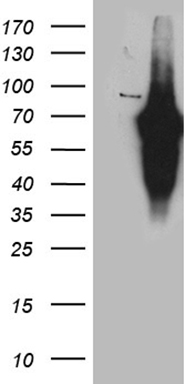 m04277 anti fklf  klf11 klf11 mouse monoclonal antibody clone id oti5a1 wb testing 1