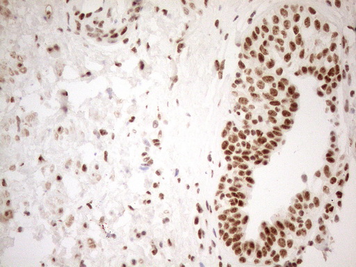 m04296 anti wtap mouse monoclonal antibody clone id oti12g7 ihc testing 10