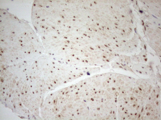 m04296 anti wtap mouse monoclonal antibody clone id oti12g7 ihc testing 11