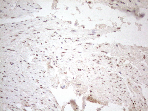 m04296 anti wtap mouse monoclonal antibody clone id oti12g7 ihc testing 12