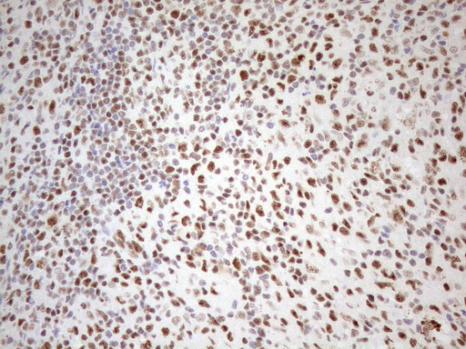 m04296 anti wtap mouse monoclonal antibody clone id oti12g7 ihc testing 13