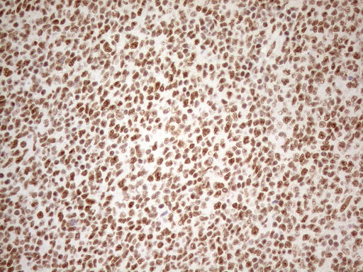 m04296 anti wtap mouse monoclonal antibody clone id oti12g7 ihc testing 14