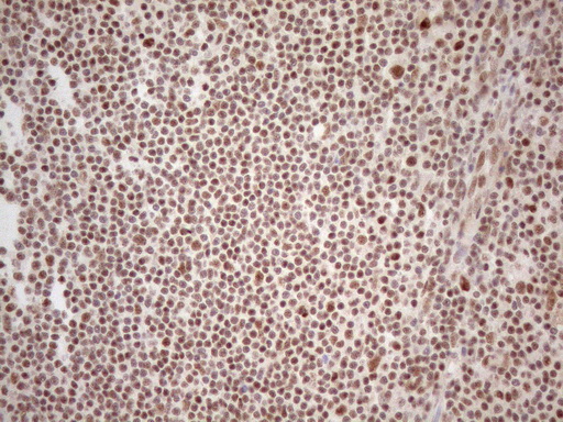 m04296 anti wtap mouse monoclonal antibody clone id oti12g7 ihc testing 15