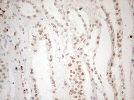 m04296 anti wtap mouse monoclonal antibody clone id oti12g7 ihc testing 18