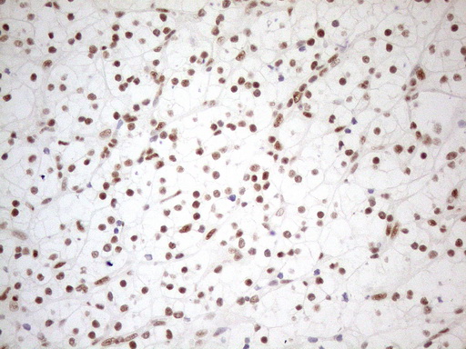 m04296 anti wtap mouse monoclonal antibody clone id oti12g7 ihc testing 19