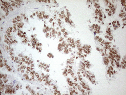 m04296 anti wtap mouse monoclonal antibody clone id oti12g7 ihc testing 2