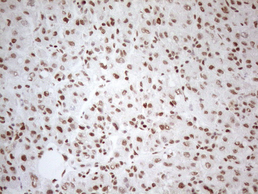m04296 anti wtap mouse monoclonal antibody clone id oti12g7 ihc testing 20