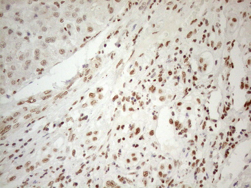 m04296 anti wtap mouse monoclonal antibody clone id oti12g7 ihc testing 21