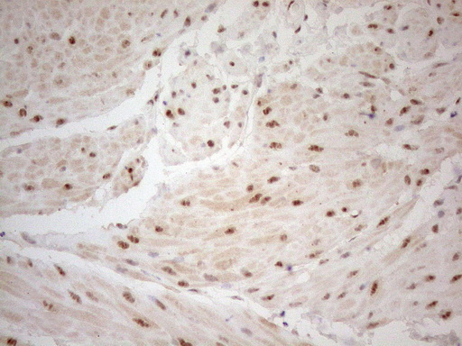 m04296 anti wtap mouse monoclonal antibody clone id oti12g7 ihc testing 22