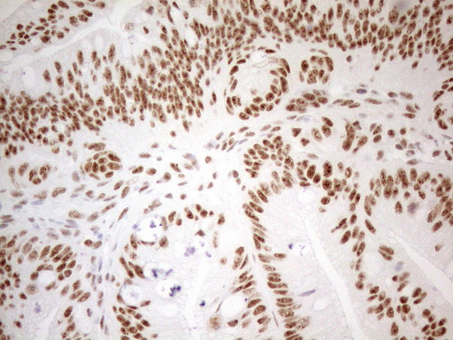 m04296 anti wtap mouse monoclonal antibody clone id oti12g7 ihc testing 4