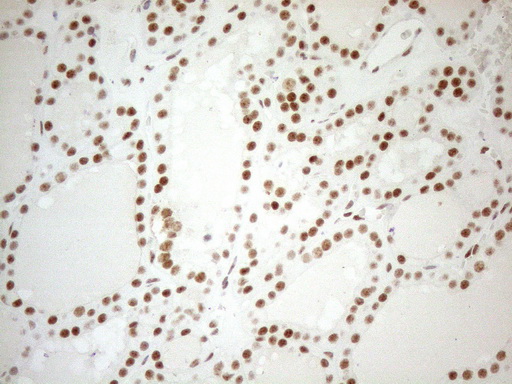 m04296 anti wtap mouse monoclonal antibody clone id oti12g7 ihc testing 5