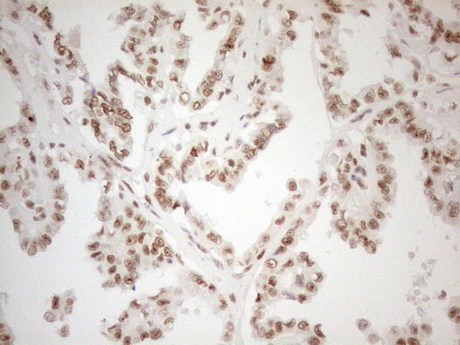 m04296 anti wtap mouse monoclonal antibody clone id oti12g7 ihc testing 6