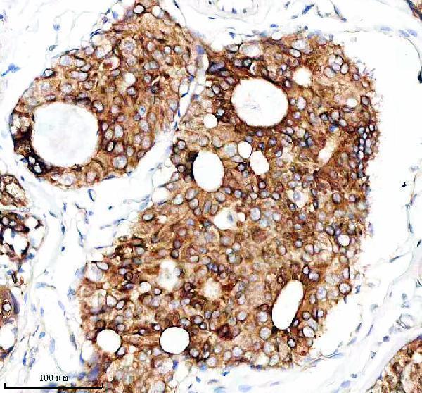 m04299 krt13 primary antibodies ihc testing 2