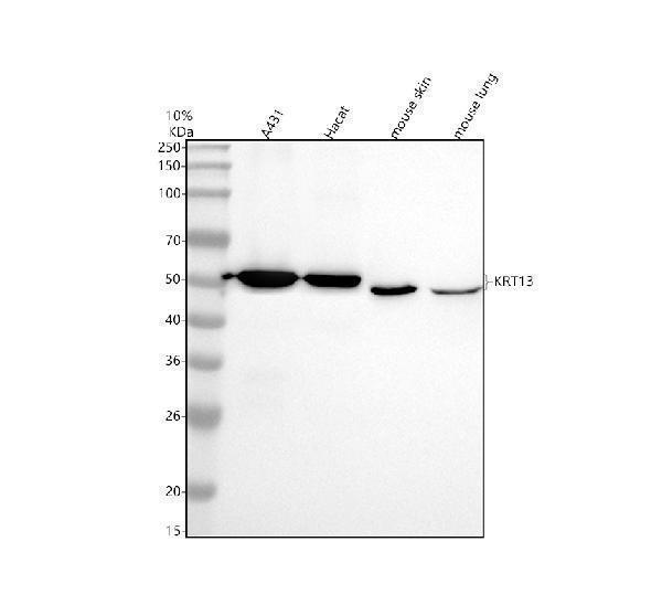 m04299 krt13 primary antibodies wb testing 1