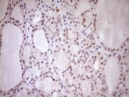 m04301 anti parg mouse monoclonal antibody clone id oti6f4 ihc testing 3