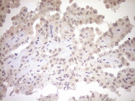 m04301 anti parg mouse monoclonal antibody clone id oti6f4 ihc testing 4