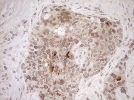 m04301 anti parg mouse monoclonal antibody clone id oti6f4 ihc testing 5