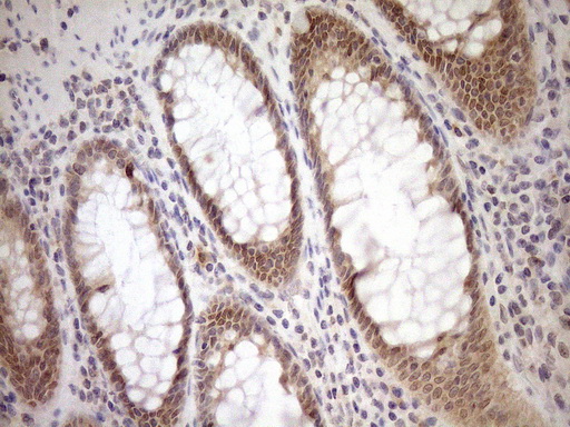 m04301 anti parg mouse monoclonal antibody clone id oti6f4 ihc testing 8