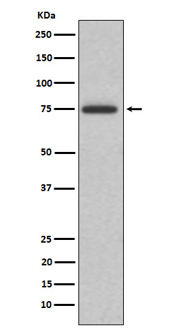 Western blot analysis of ABI2 expression in K562 cell lysate