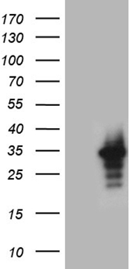HEK293T cells were transfected with the pCMV6-ENTRY control (Left lane) or pCMV6-ENTRY RRAS (Right lane) cDNA for 48 hrs and lysed