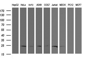 Western blot analysis of extracts (35ug) from 9 different cell lines by usin g anti-RYBP monoclonal antibody (HepG2: human; HeLa: human; SVT2: mouse; A549: human; COS7: monkey; Jurkat: human; MDCK: canine; PC12: rat; MCF7: human)