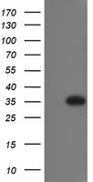 HEK293T cells were transfected with the pCMV6-ENTRY control (Left lane) or pCMV6-ENTRY RYBP (Right lane) cDNA for 48 hrs and lysed