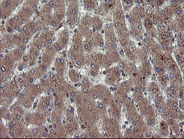 m04316 anti rybp mouse monoclonal antibody clone id oti1b2 ihc testing 10