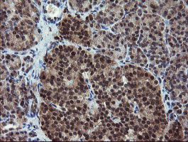 m04316 anti rybp mouse monoclonal antibody clone id oti1b2 ihc testing 4