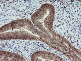 m04316 anti rybp mouse monoclonal antibody clone id oti1b2 ihc testing 6