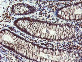 m04316 anti rybp mouse monoclonal antibody clone id oti1b2 ihc testing 8