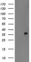 HEK293T cells were transfected with the pCMV6-ENTRY control (Left lane) or pCMV6-ENTRY RYBP (Right lane) cDNA for 48 hrs and lysed