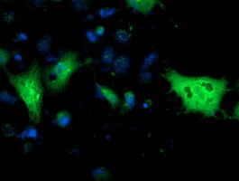 m04317 anti monoacylglycerol lipase mgll mouse monoclonal antibody clone id oti1h1 if testing 20