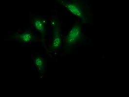 m04317 anti monoacylglycerol lipase mgll mouse monoclonal antibody clone id oti1h1 if testing 21