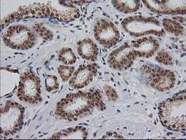 m04317 anti monoacylglycerol lipase mgll mouse monoclonal antibody clone id oti1h1 ihc testing 10