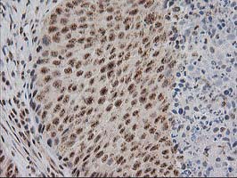m04317 anti monoacylglycerol lipase mgll mouse monoclonal antibody clone id oti1h1 ihc testing 11
