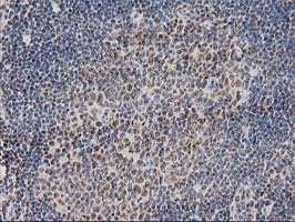 m04317 anti monoacylglycerol lipase mgll mouse monoclonal antibody clone id oti1h1 ihc testing 12
